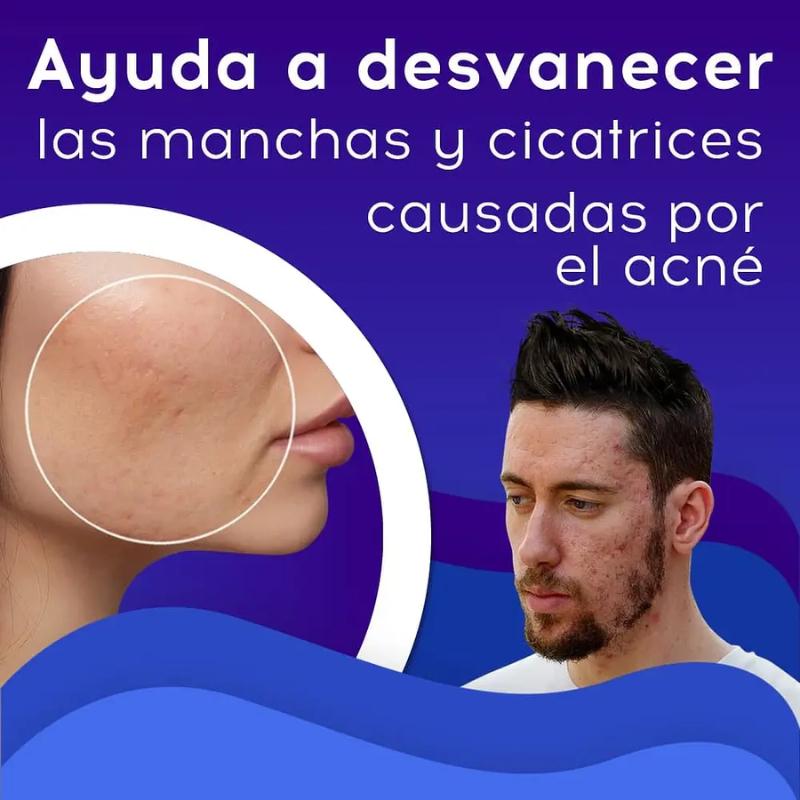 Crema Antiacné y Cicatrices Bioaqua Original