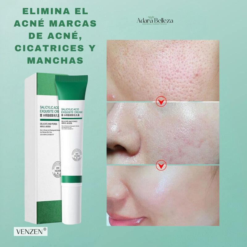 Kit Antiacné Bioaqua Limpieza Profunda