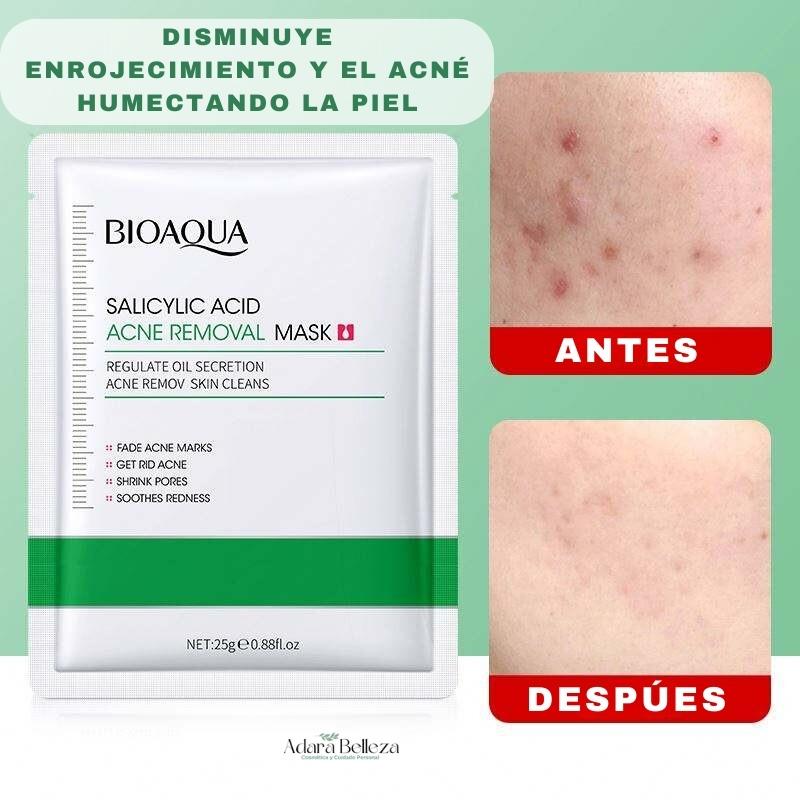 Kit Antiacné Bioaqua Limpieza Profunda
